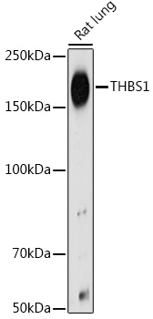 THBS1 Rabbit polyclonal antibody