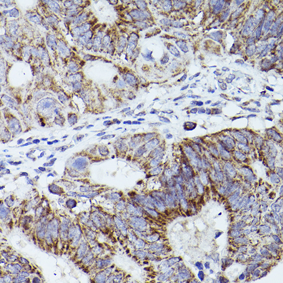 THBS1 Rabbit polyclonal antibody
