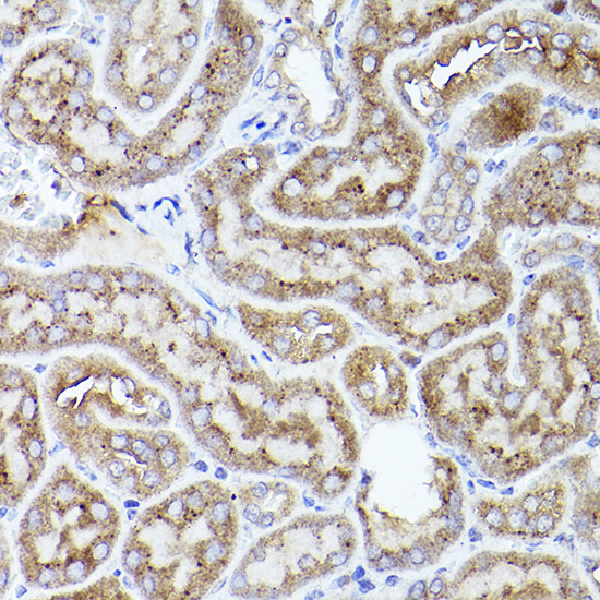 THBS1 Rabbit polyclonal antibody