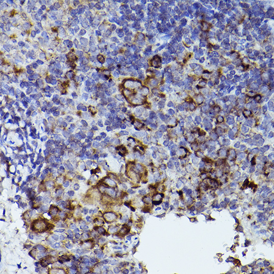 THBS1 Rabbit polyclonal antibody