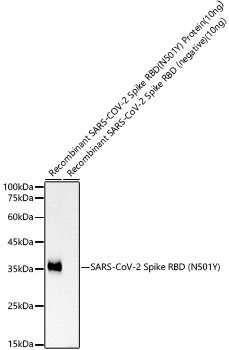 SARS-CoV-2 Spike RBD (N501Y) Rabbit mAb