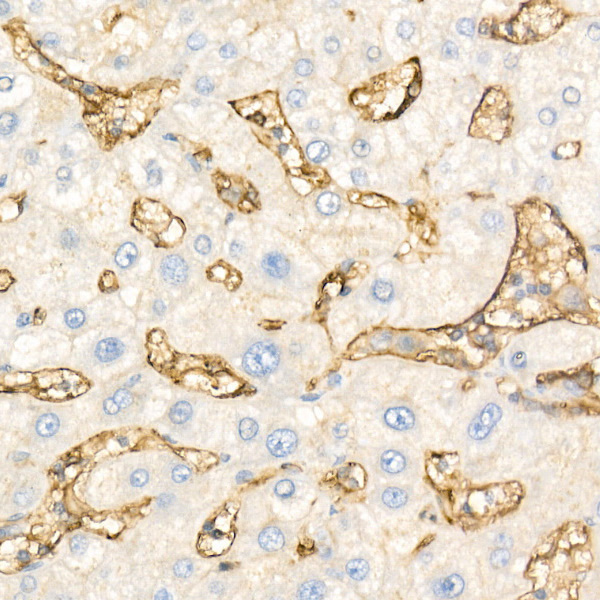 CD14 Rabbit monoclonal antibody