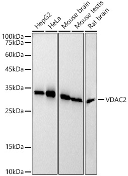 VDAC2 Rabbit monoclonal antibody