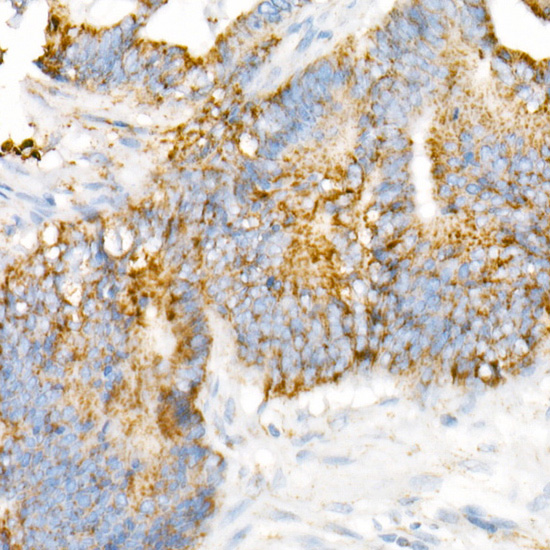 VDAC2 Rabbit monoclonal antibody
