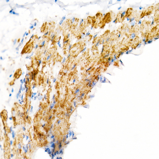 VDAC2 Rabbit monoclonal antibody