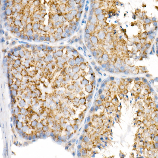 VDAC2 Rabbit monoclonal antibody
