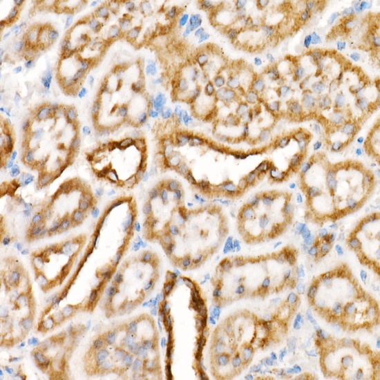 VDAC2 Rabbit monoclonal antibody