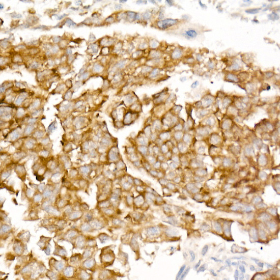 LIN28A Rabbit monoclonal antibody