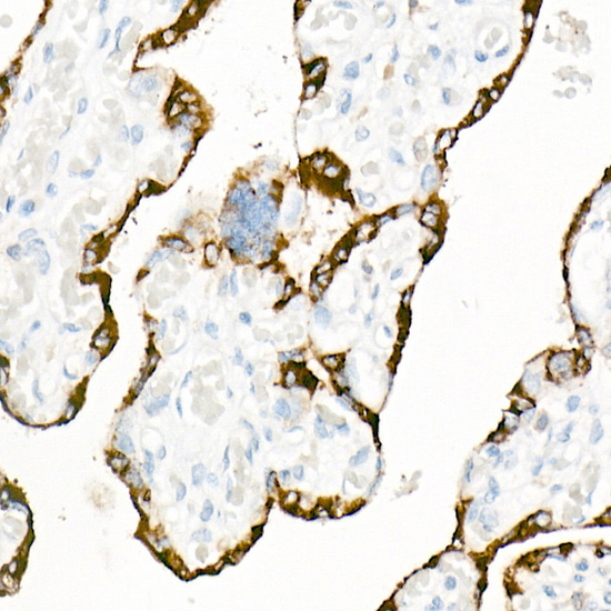 LIN28A Rabbit monoclonal antibody