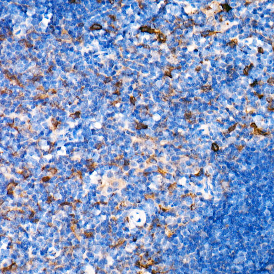 Interferon alpha 2 (IFN-A Alpha2) Rabbit monoclonal antibody