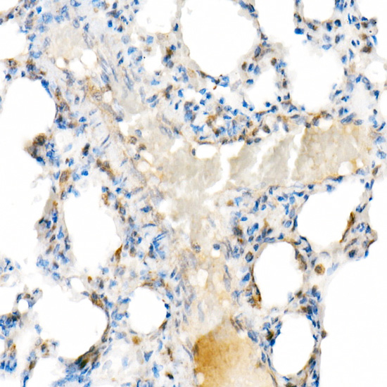 Interferon alpha 2 (IFN-A Alpha2) Rabbit monoclonal antibody