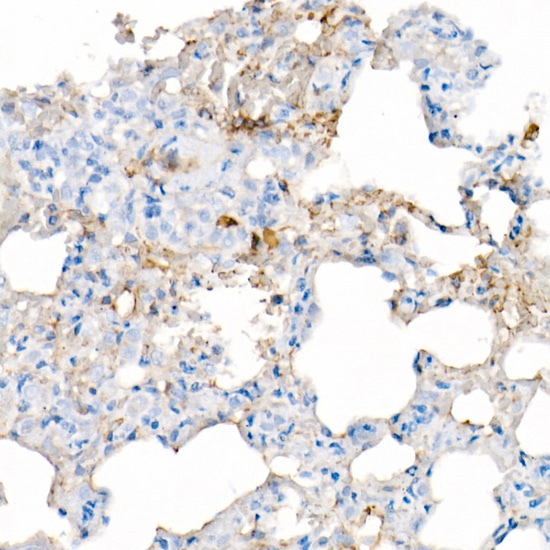 IL-6 Rabbit monoclonal antibody