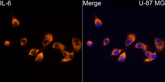 IL-6 Rabbit monoclonal antibody