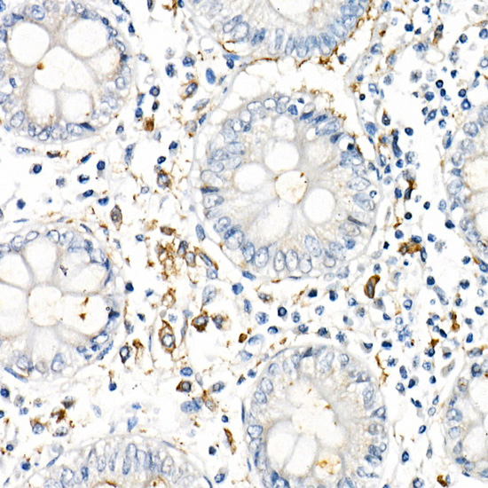 TNF-A Alpha Rabbit monoclonal antibody