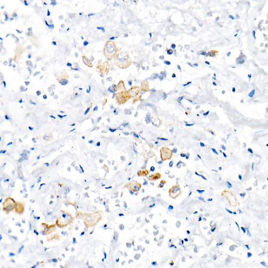 TNF-A Alpha Rabbit monoclonal antibody