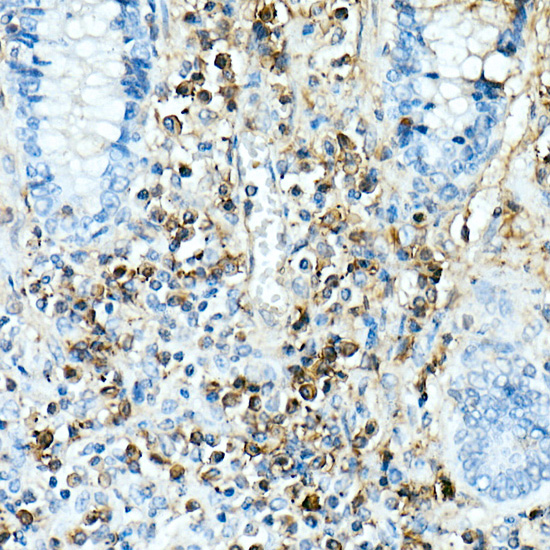 IL17A Rabbit monoclonal antibody
