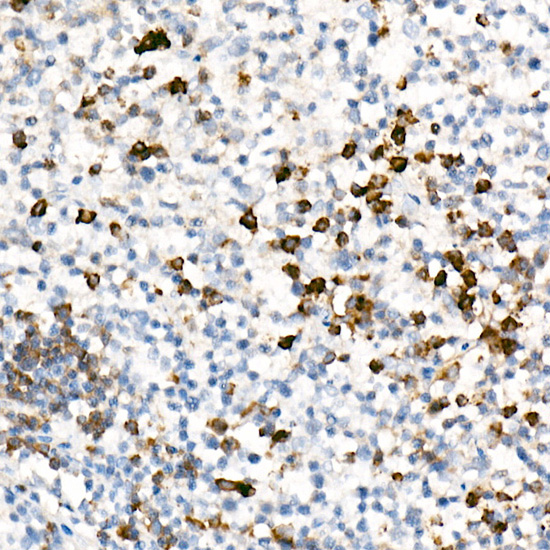 IL17A Rabbit monoclonal antibody