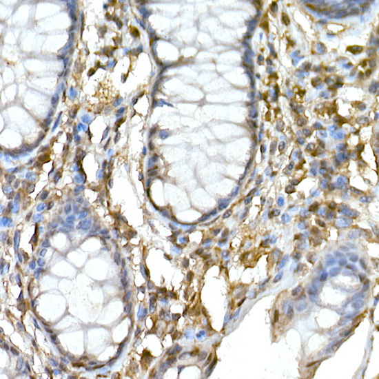 TNFAIP3 Rabbit polyclonal antibody