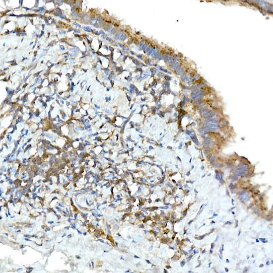 TNFAIP3 Rabbit polyclonal antibody