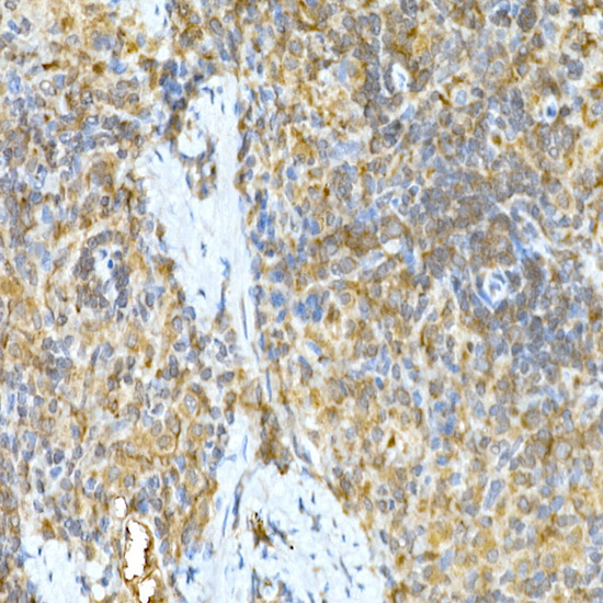 TNFAIP3 Rabbit polyclonal antibody