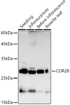 COR28 Rabbit polyclonal antibody