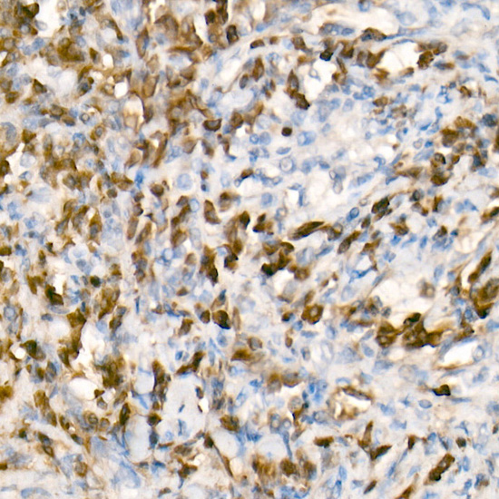 Human IgG (Fc) Rabbit monoclonal antibody