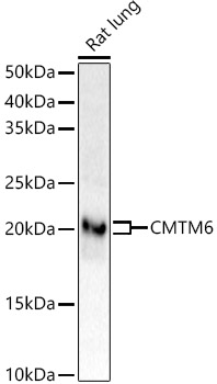 CMTM6 Rabbit monoclonal antibody