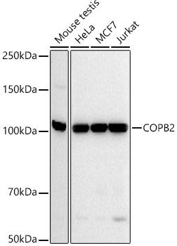 COPB2 Rabbit mAb