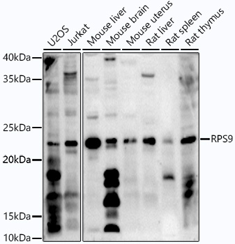 RPS9 Rabbit polyclonal antibody