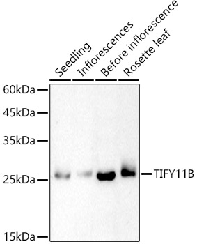TIFY11B Rabbit polyclonal antibody