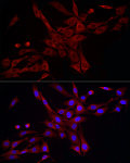 Immunofluorescence - DNM1L Rabbit pAb (A21311)