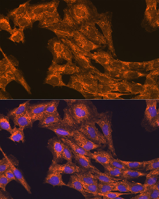 VEGFB Rabbit polyclonal antibody