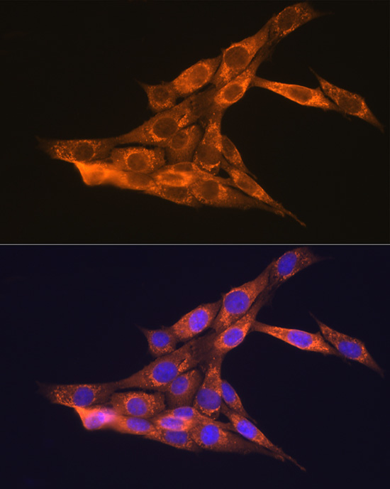 VEGFB Rabbit polyclonal antibody