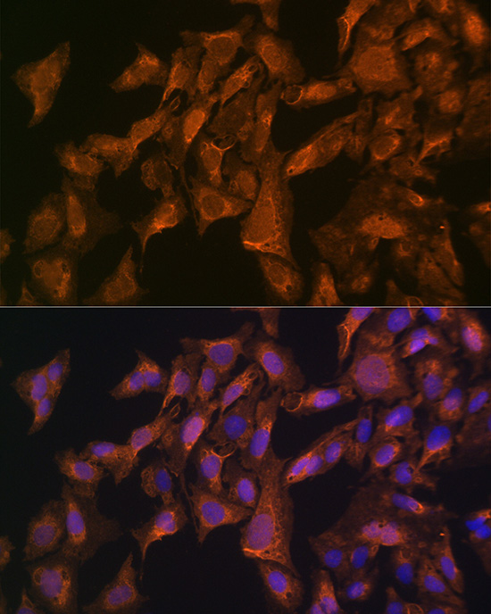 VEGFB Rabbit polyclonal antibody