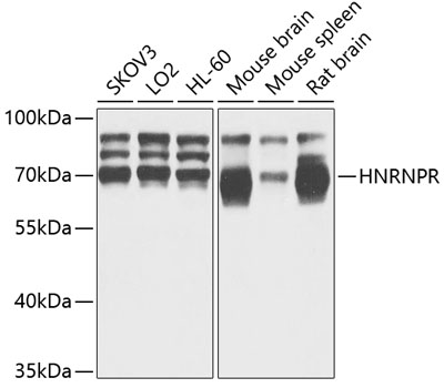 HNRNPR Rabbit polyclonal antibody
