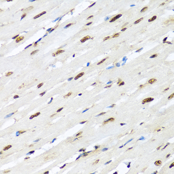 HNRNPR Rabbit polyclonal antibody