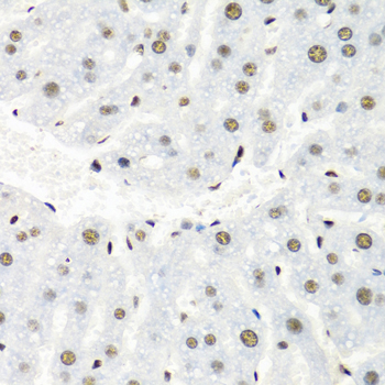 HNRNPR Rabbit polyclonal antibody