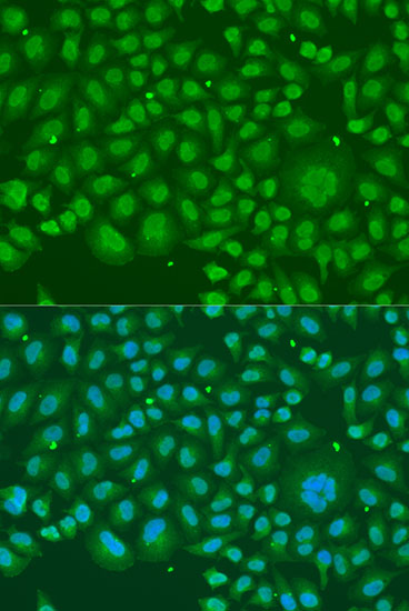 HNRNPR Rabbit polyclonal antibody