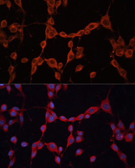 GNA13 Rabbit polyclonal antibody
