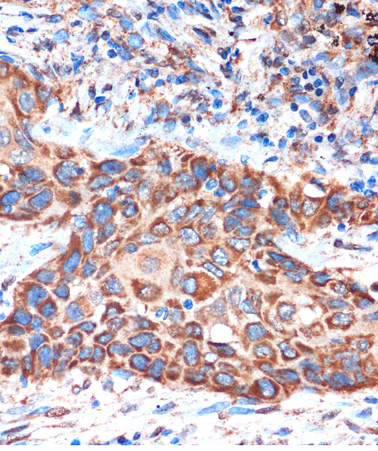 HIBADH Rabbit polyclonal antibody