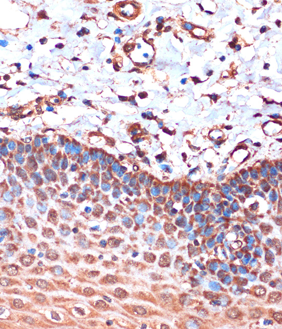 HIBADH Rabbit polyclonal antibody