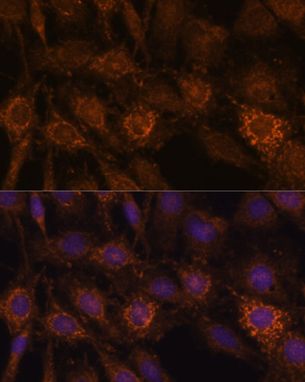 HIBADH Rabbit polyclonal antibody