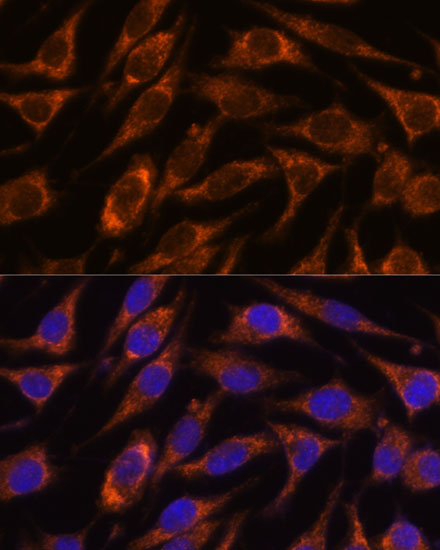 HIBADH Rabbit polyclonal antibody