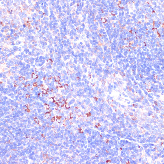 Zyxin Rabbit polyclonal antibody