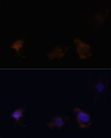 Zyxin Rabbit polyclonal antibody
