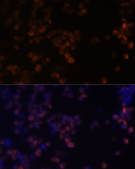 Zyxin Rabbit polyclonal antibody