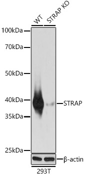 [KO Validated] STRAP Rabbit polyclonal antibody