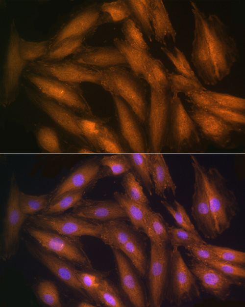 [KO Validated] STRAP Rabbit polyclonal antibody