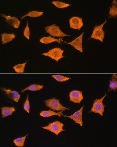 [KO Validated] STRAP Rabbit polyclonal antibody