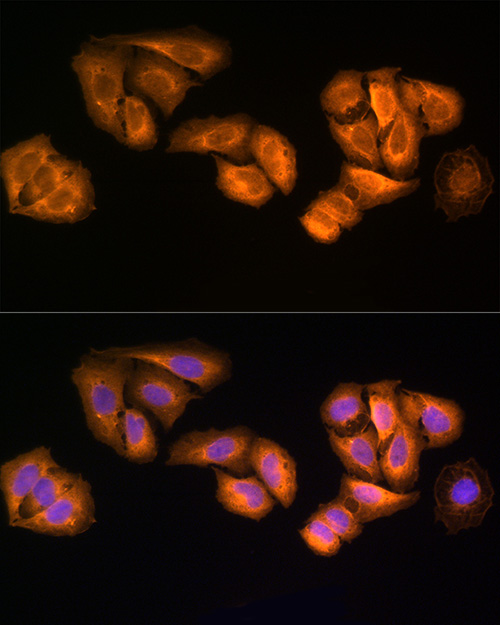 [KO Validated] STRAP Rabbit polyclonal antibody